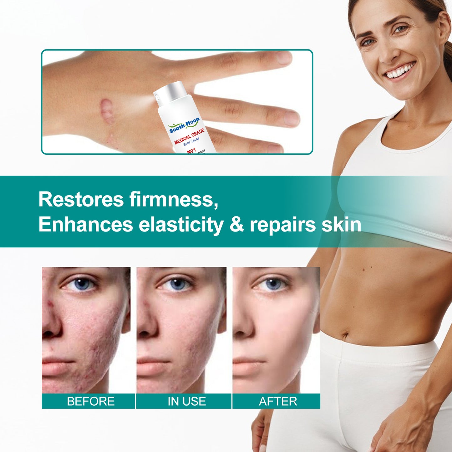 ScarRemove - Surgical Scar Smoothing Skin Care Spray